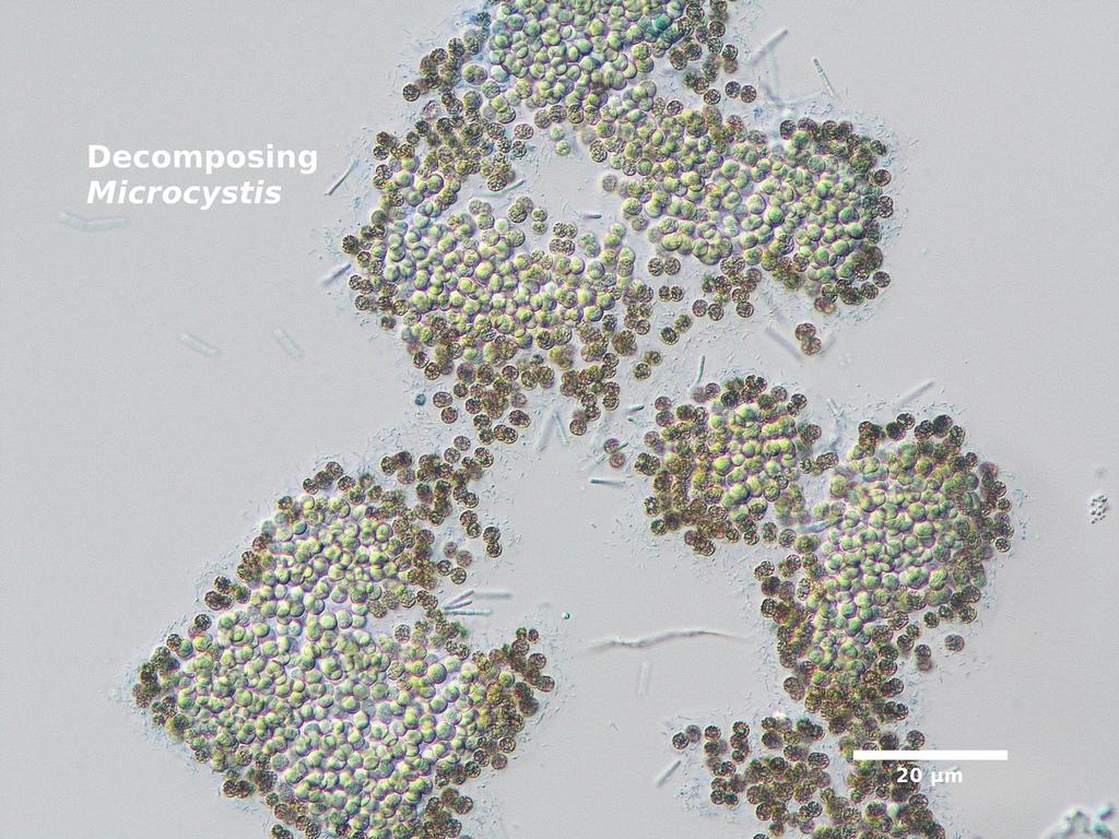 Microcystis aeruginosa